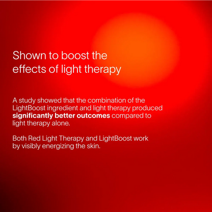 4-in-1 Red Light Therapy Wand & Activating Serum Kit Solawave